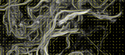 Vector field overlaid on an image
